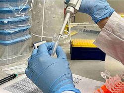 Flüssigkeit wird mit Pipette im Labor untersucht – Symbolbild