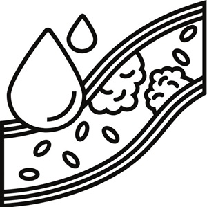 Symbol: Blutgefäß mit Fettablagerungen – Thema Cholesterin.